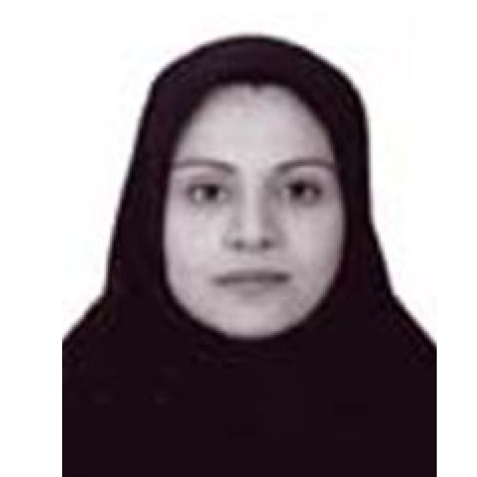 دکتر الینا غفاری - شبکیه (ویتره و رتین) تهران