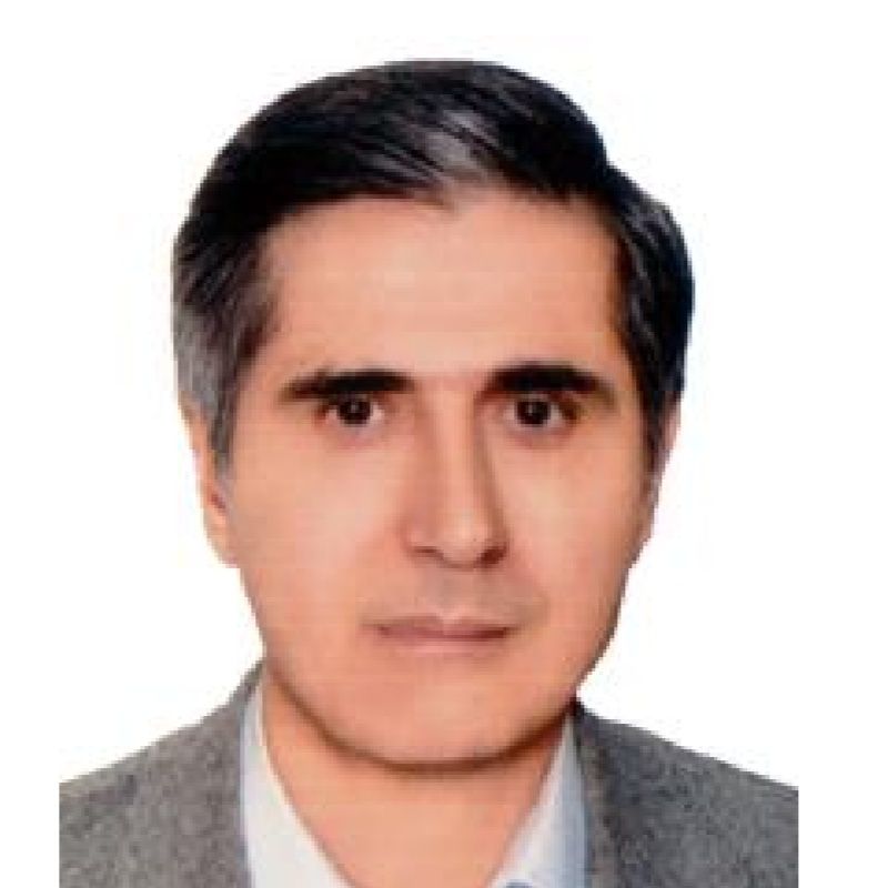 دکتر پرویز محمدی مزلقانی - قرنیه تهران