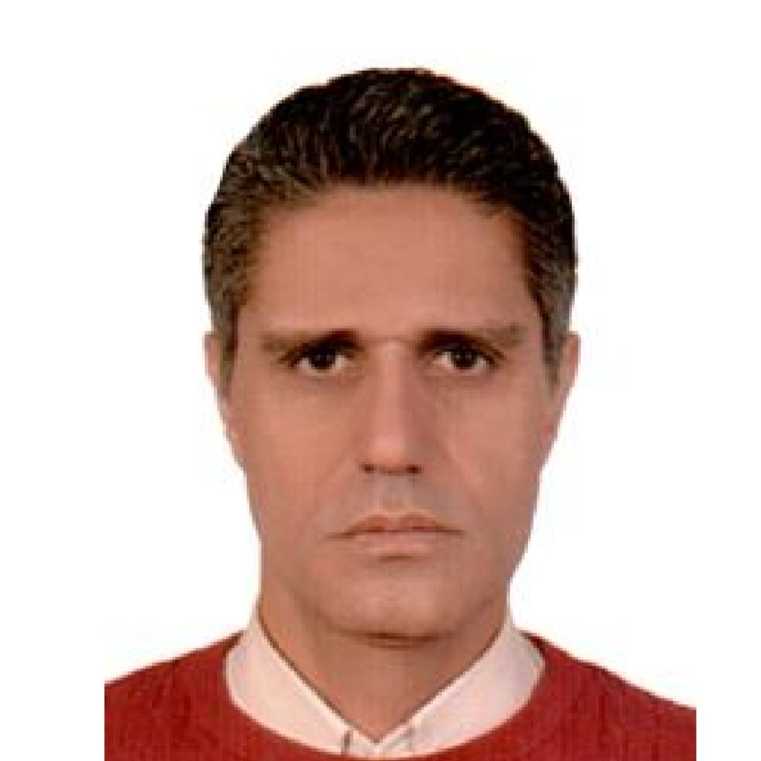 دکتر محمود مطلبی - شبکیه (ویتره و رتین) تهران