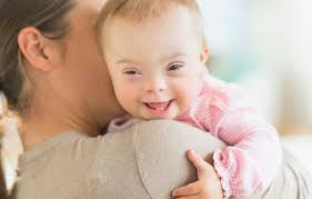 معرفی بهترین و معتبر ترین آزمایشگاه های غربالگری  سندرم داون