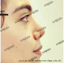 دکتر عباس نوروزی جراح بینی در کرج