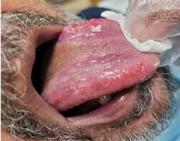 دکتر علی اصغر نادری متخصص دهان فک و صورت در مهرشهر کرج