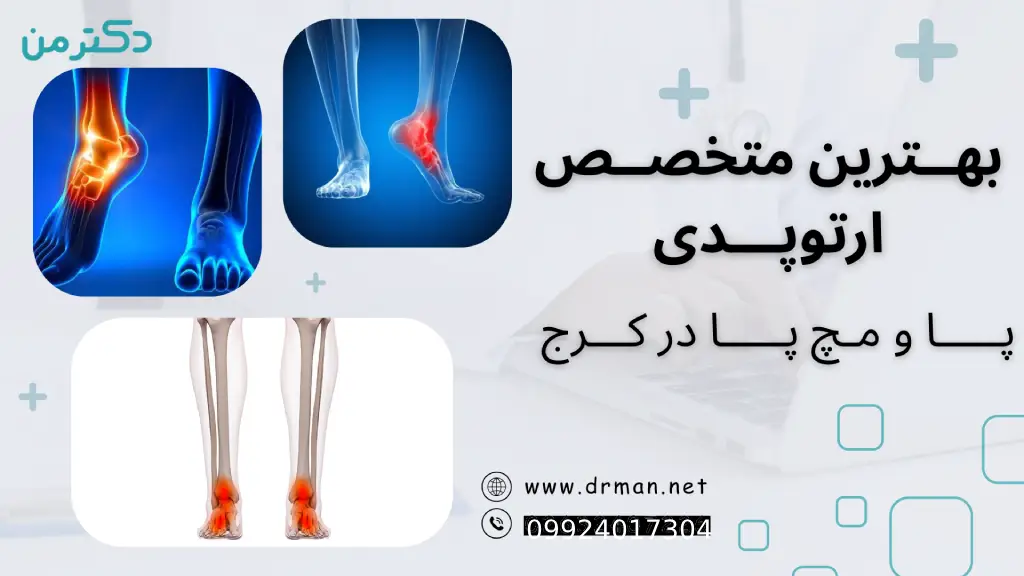 بهترین فوق تخصص ارتوپدی پا و مچ پا در کرج| فوق تخصص ارتوپدی در کرج